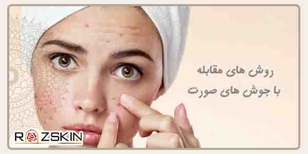 روش های مقابله با جوش های صورت