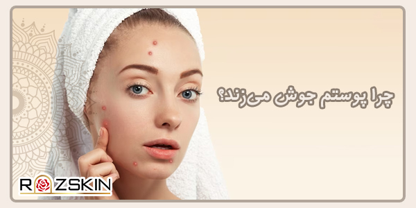 چرا پوستم جوش می‌زند؟