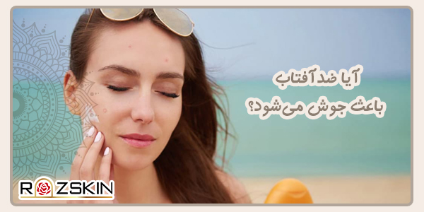 آیا ضدآفتاب باعث جوش می‌شود؟