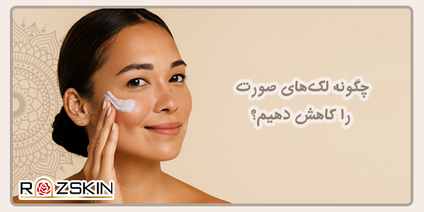 چگونه لک‌های صورت را کاهش دهیم؟